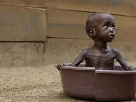 ВООЗ: 60% дитячих смертей припадає на країни Азії та Африки