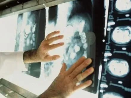 Державну програму з онкології можуть затвердити лише у 2018 році — нардеп