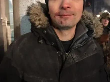 Під час зіткнень в центрі Києва побили нардепа Є.Соболєва