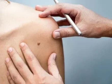 Учені створили програму для смартфона, що діагностує рак