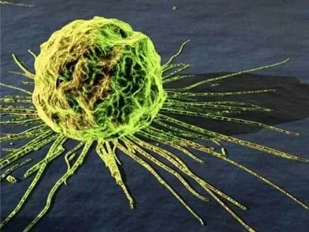 ООН: у 2030 році неінфекційні захворювання заберуть життя 52 млн осіб