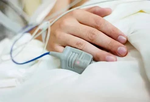 Стан трьох осіб, що постраждали у ДТП на Миколаївщині, важкий - медики