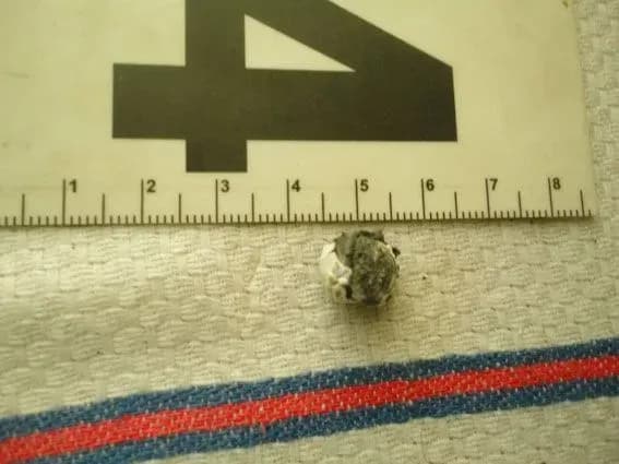 Чоловіку на Одещині вистрелили п'ять разів у голову