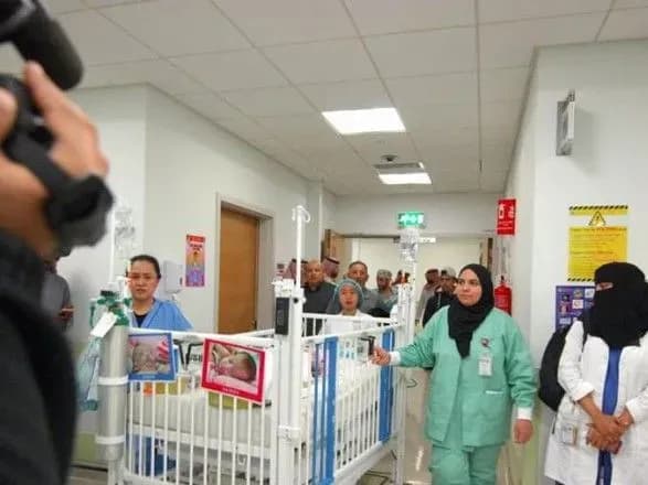 Успішну операцію з розділення сіамських близнюків провели у Саудівській Аравії