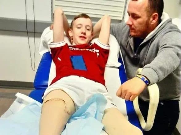 У Північній Ірландії підлітку пришили ногу задом наперед