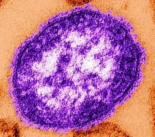 Від початку року у Львові на кір захворіли 122 людини