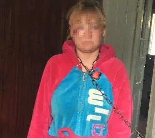 Жінку в Одесі прикували за шию до стіни