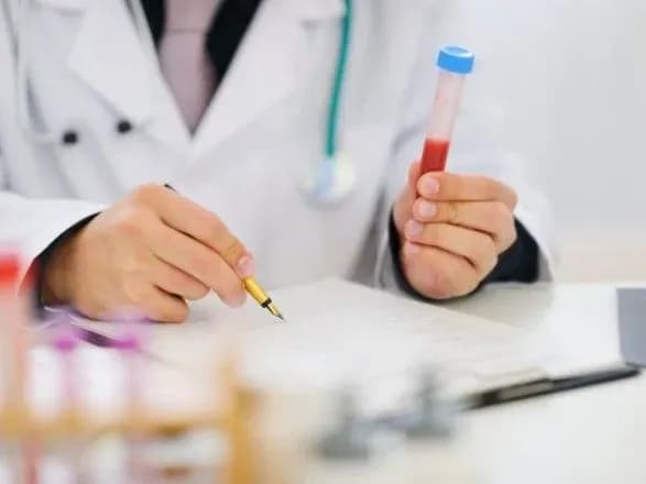 Українські лікарні масово скуповують тест-системи у російської компанії