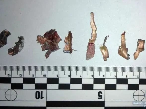 У Костянтинівці підлітку відірвало руку внаслідок вибуху боєприпасу