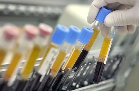 До Харкова знову завезли малярію з Нігерії