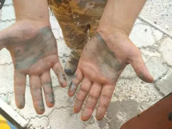 П'ятьох госпіталізованих херсонських прикордонників два дні обстежуватимуть лікарі