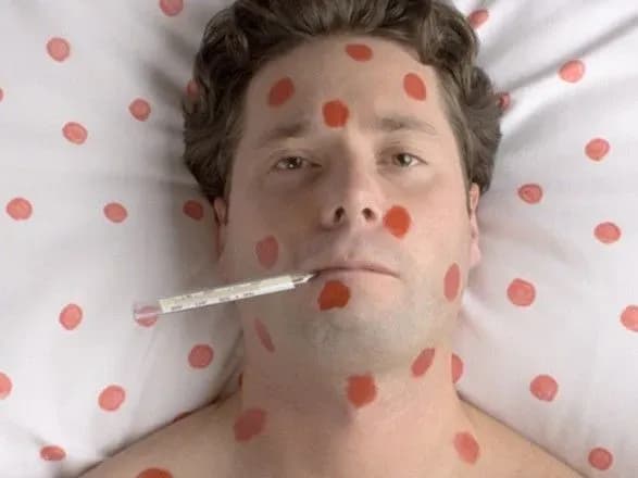 Кір на експорт: країни-сусіди б’ють на сполох через епідемію в Україні