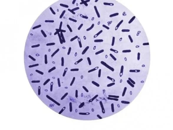 У жителя Кіровоградської області підозрюють ботулізм