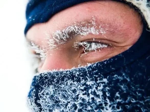 За місяць від переохолодження та обморожень постраждали більше тисячі українців