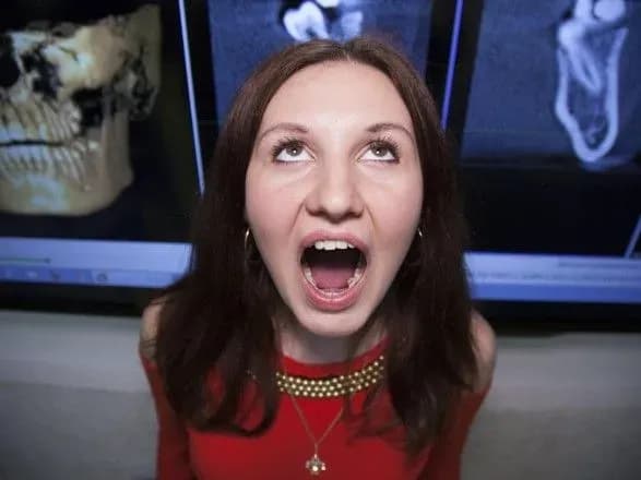 В Україні знайшли найзубастішу жінку