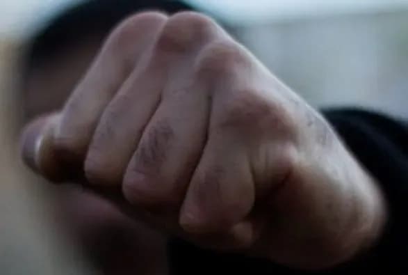 У Чернівцях 16-річний помстився ударом ноги в обличчя хлопцю за образу сестри