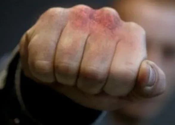 На Донеччині чоловіку повідомили про підозру за побиття батька