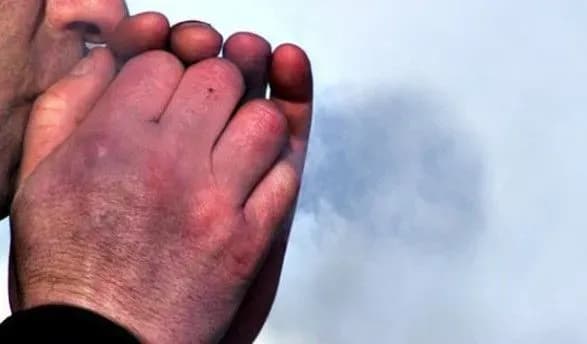 У Харкові після переохолодження помер чоловік