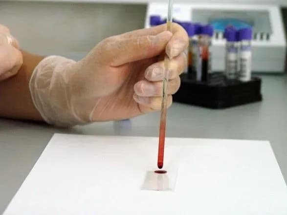 Хірурга запідозрили в недбалості, яка призвела до смерті пацієнтки