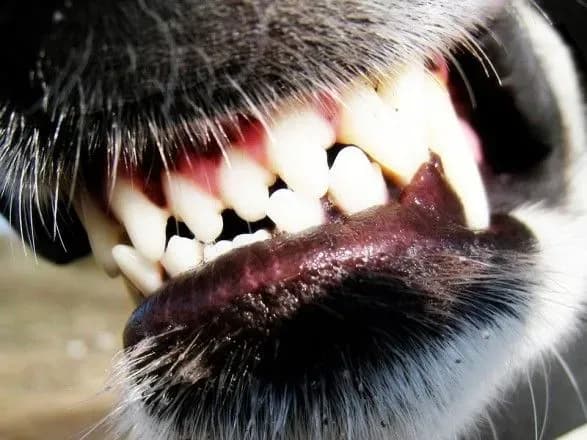 На дитячому майданчику на 4-річного хлопчика напав бійцівський собака