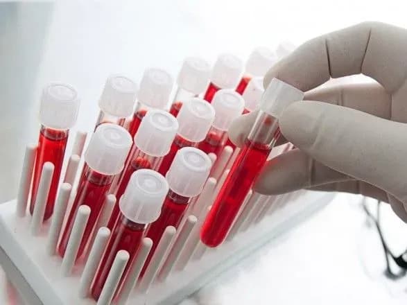 VADA: аналізи кандидатів у президенти перевірять у США