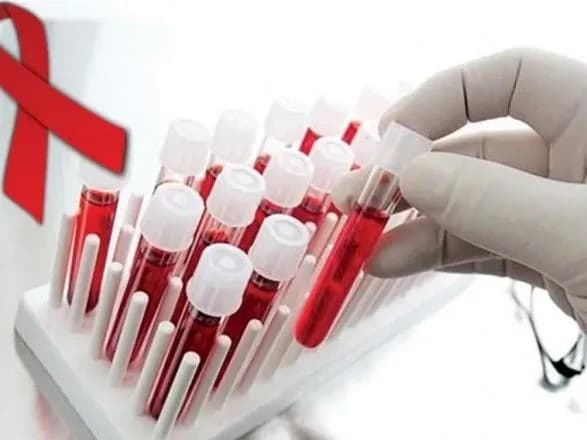 МОЗу дозволили за бюджетні кошти закуповувати послуги із супроводу і профілактики ВІЛ