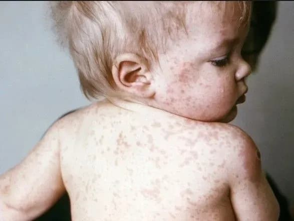 Половина українців не вірить у ефективність вакцин – дослідження