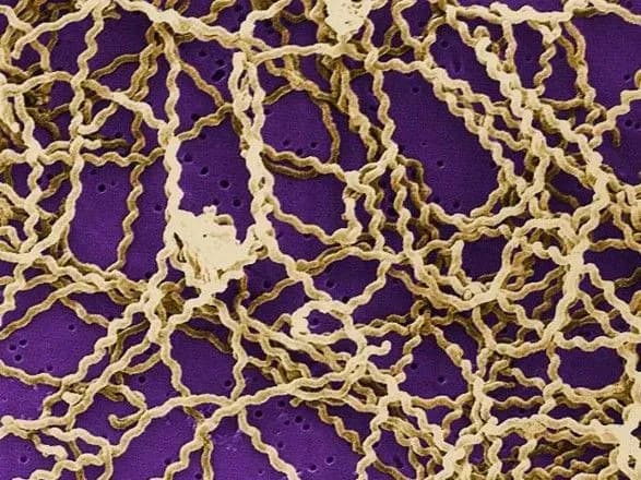 На Кіровоградщині чоловік помер від лептоспірозу