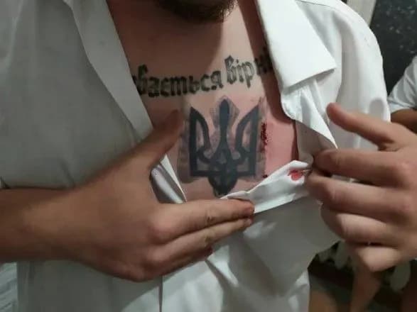 У Хмельницькій області кандидата у нардепи вдарили ножем у груди