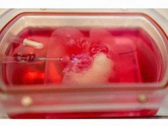 Вчені вперше виростили ГМО-печінку людини