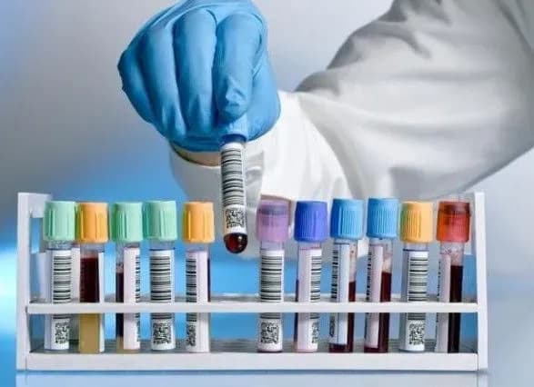 У чернігівській школі зафіксували 13 випадків гепатиту