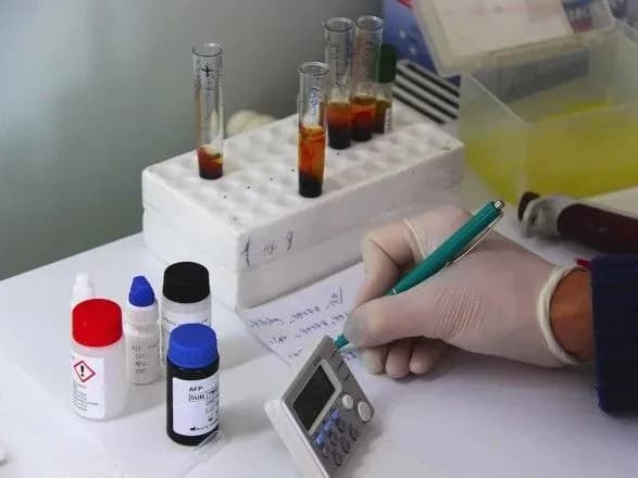 На Харківщині гепатитом А захворіли 13 людей