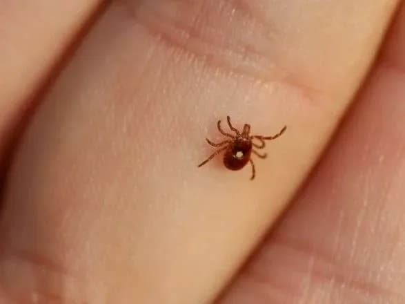 Випадок хвороби Лайма зареєстрували в Кропивницькому