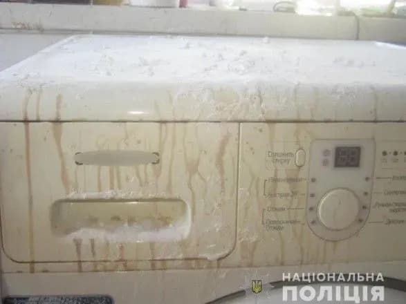 На Київщині судитимуть чоловіка за те, що він плеснув кислотою в дружину