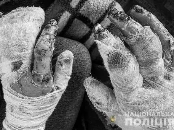 Вибух у клубі на Тернопільщині: з картки вкрали зібрані кошти на лікування поранених дітей