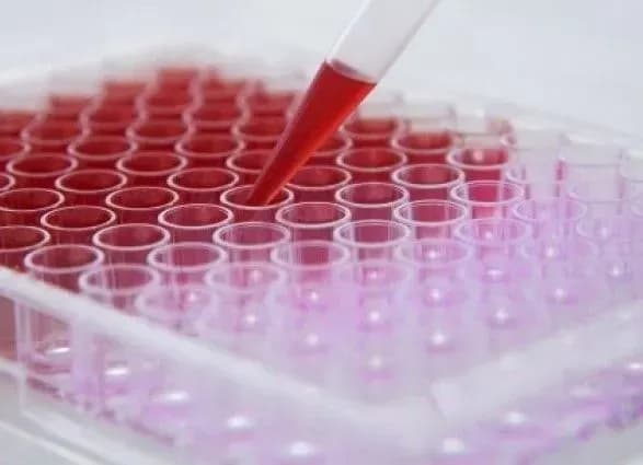 Україна отримала тест-систему для виявлення нового коронавірусу - МОЗ