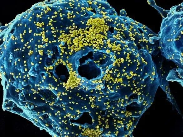 В Україні на сьогодні не зафіксовано жодного підтвердженого випадку COVID-19 – МОЗ