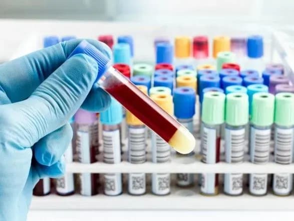 На Сумщині госпіталізовано одну особу з підозрою на коронавірус