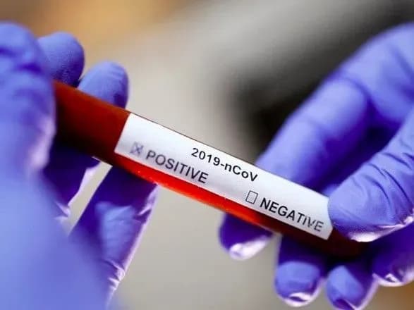 У Києві перевіряють на коронавірус ще понад 30 осіб