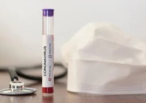 На Сумщині за минулу добу нових інфікувань коронавірусом не зафіксовано