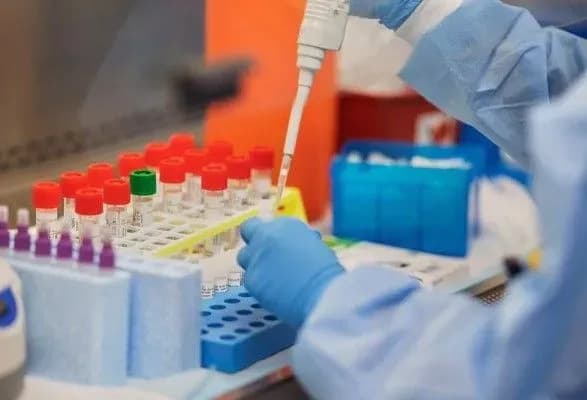 Ще 14 випадків COVID-19 зафіксували на Полтавщині
