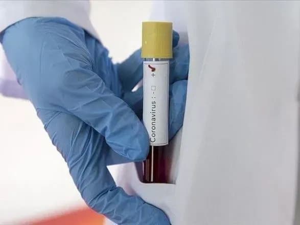 Ще одна людина померла від коронавірусу на Кіровоградщині