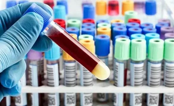 Десятки человек заразились коронавирусом в реабилитационных центрах: открыто три производства