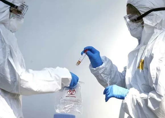 В США эпидемия коронавируса может привести к росту ВИЧ и инфекций, передающихся половым путем - медики