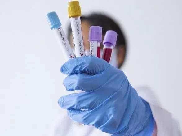 МОЗ отримало вже близько півмільйона вітчизняних ПЛР-тестів - Зеленський