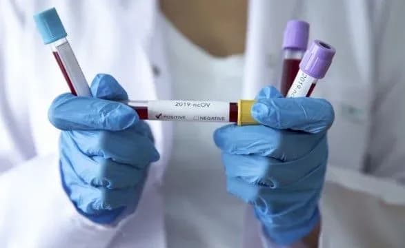 На Дніпропетровщині від COVID-19 одужало 16 осіб