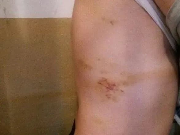 У Кропивницькому СІЗО знущалися з двох затриманих - Денісова