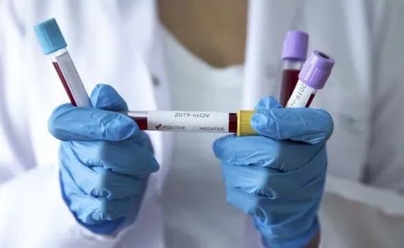 Пандемія коронавірусу примножила солідарність та взаємодовіру серед українців - опитування