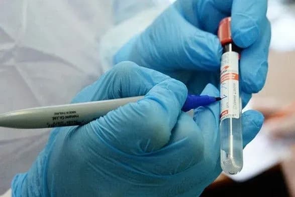 В Україні вже понад 16 тис. випадків COVID-19, з них 425 летальні