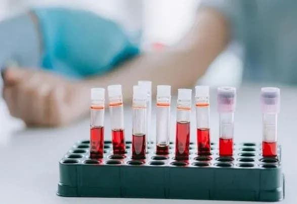 Кличко після спалаху COVID-19 в інтернаті для дівчат оголосив перевірку низки закладів